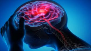 Cegah Stroke Sejak Dini, Ini 8 Makanan yang Direkomendasikan Dokter untuk Menjaga Pembuluh Darah Tetap Sehat