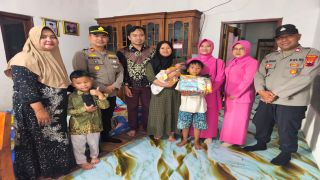 Polri Beri Dukungan Bayi dengan Kondisi Kaki Pengkor di Balapulang